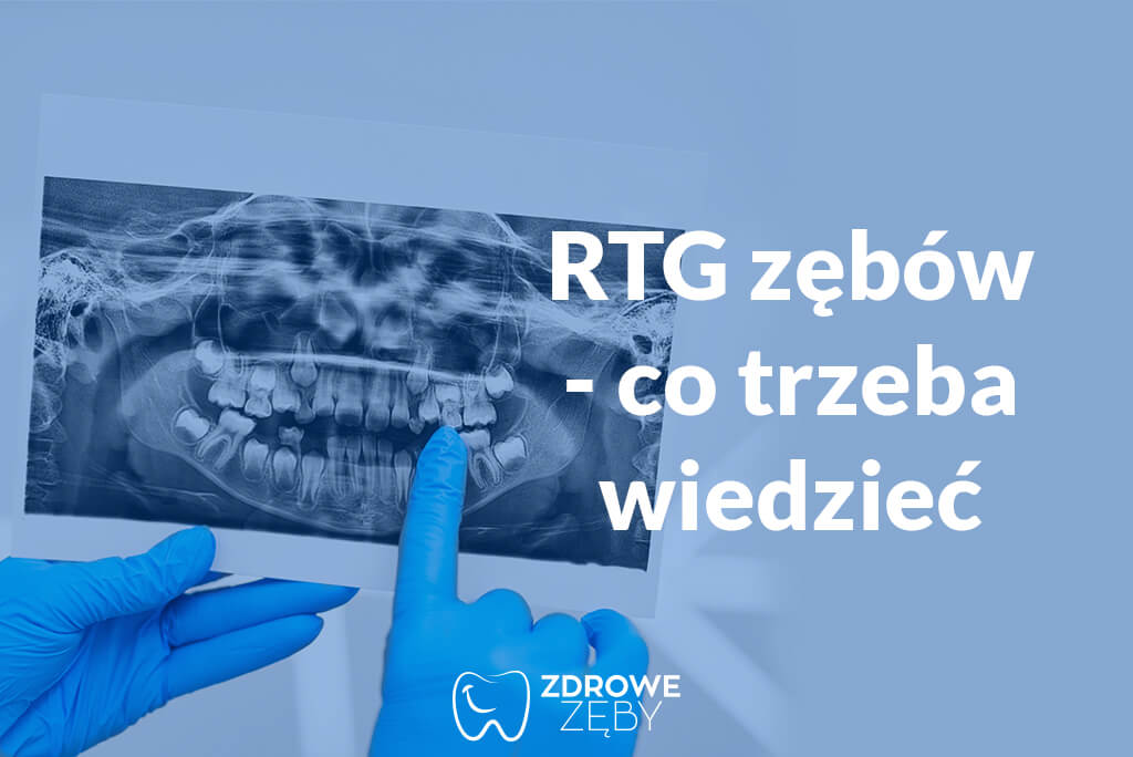 RTG zębów
